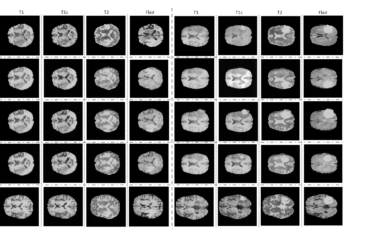 brain