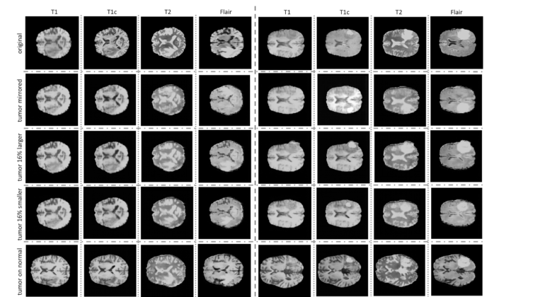 brain