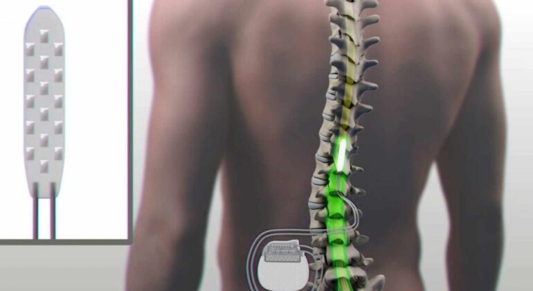 dispositivo-paralitico_0