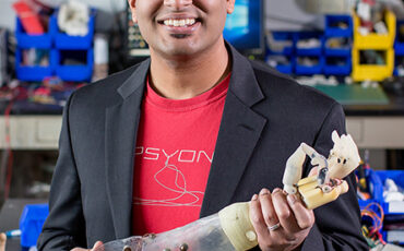 smart-prosthesis